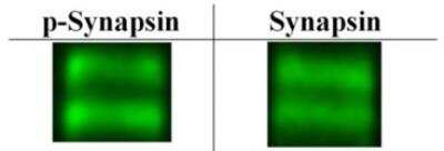 Western Blot: Synapsin I [p Ser603] Antibody [NB300-181]